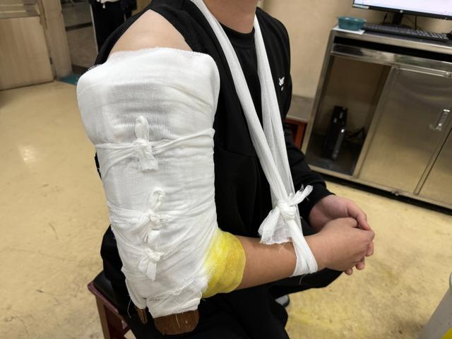 手被旋转木马卡骨折